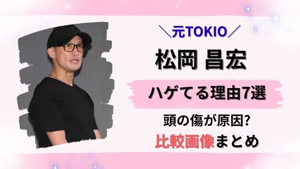 松岡昌宏がハゲてると言われる理由と比較画像があることを伝えてます。